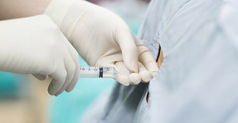 epidural steroid injection coding